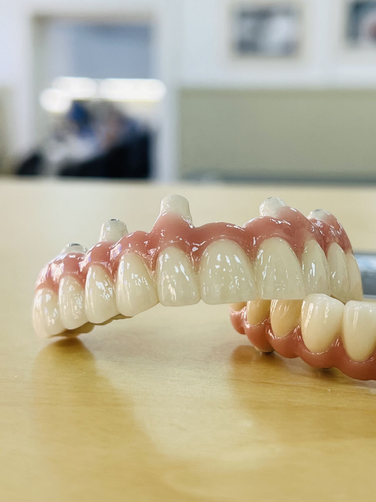 Skräddarsydd protetik